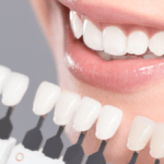 Health Tips For Teeth