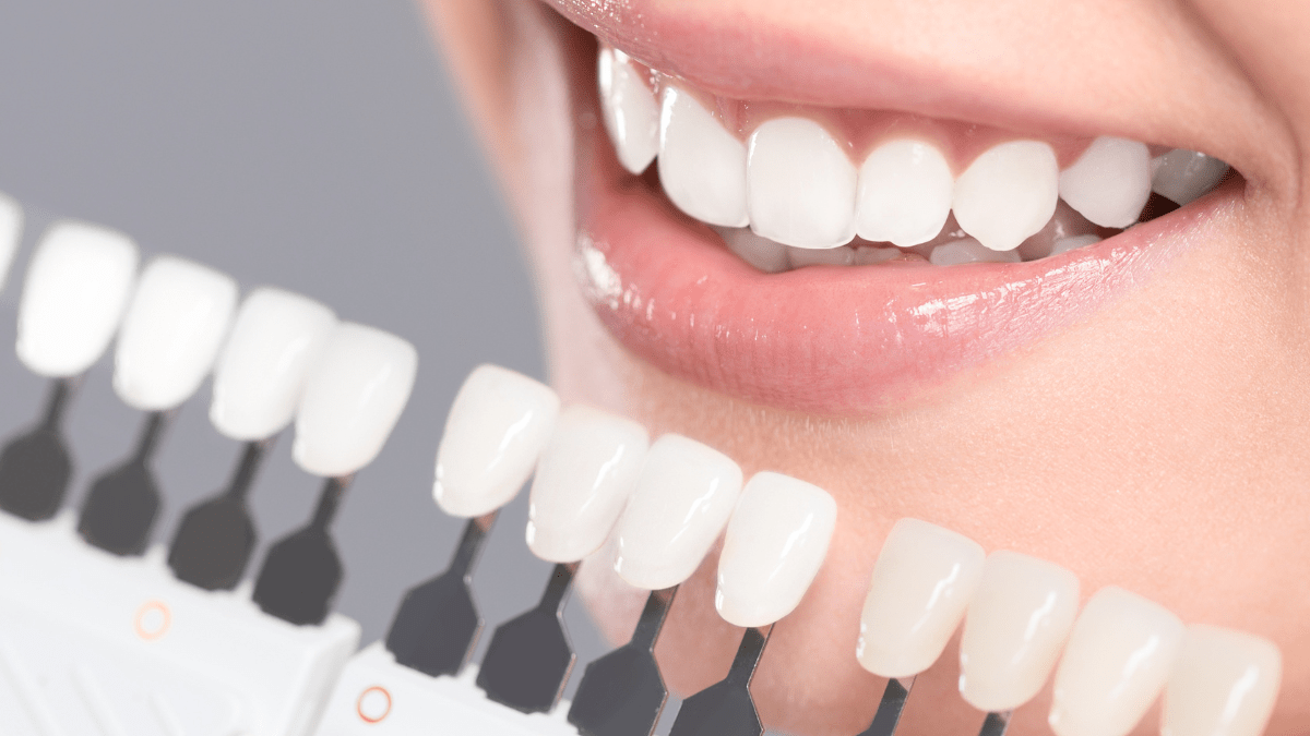 Health Tips For Teeth